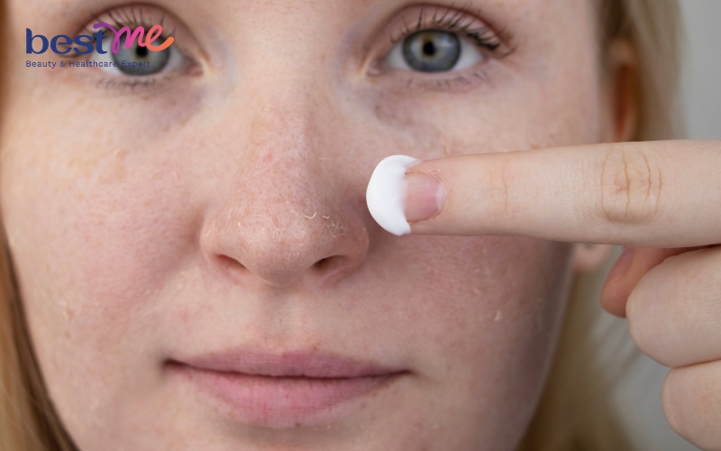 Da khô nên chọn sản phẩm có kết cấu hơi đặc