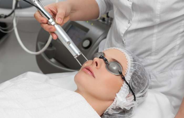 Công nghệ Laser được đánh giá là phương pháp điều trị tàn nhang nhanh chóng và hiệu quả