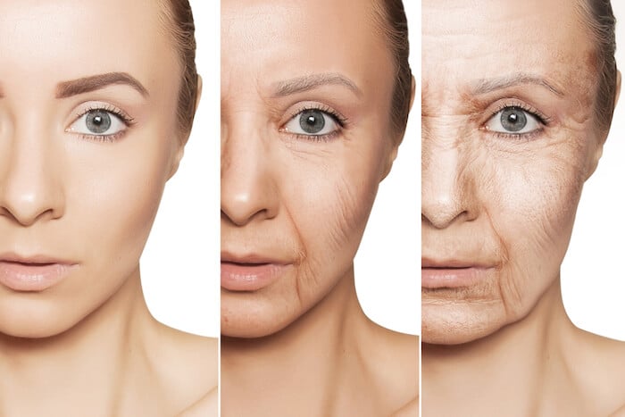 Collagen giúp làm mờ các rãnh, nếp nhăn trên bề mặt da