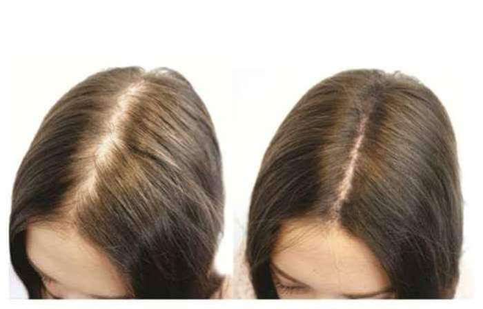Dầu gội kích thích mọc tóc giúp ngăn rụng tóc, kích thích mọc tóc mới, bổ sung dưỡng chất nuôi dưỡng da đầu và sợi tóc