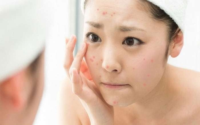 Làn da đang bị tổn thương nên bổ sung peptide để cải thiện da