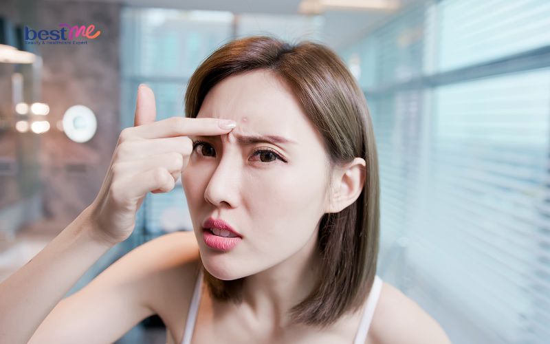 Da dầu có cần dưỡng ẩm không? Có nên dùng kem dưỡng ẩm? - 5