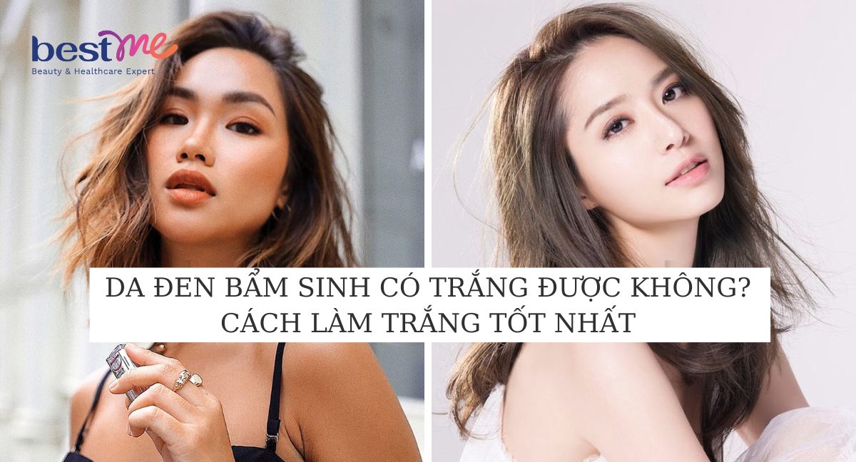 Da đen bẩm sinh có trắng được không? Làm sao để trắng tại nhà?