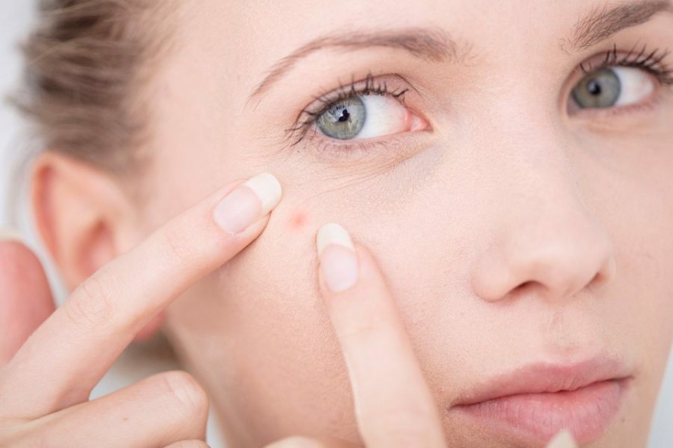 Dưỡng da cho da mụn cùng kem che khuyết điểm DHC Acne Care