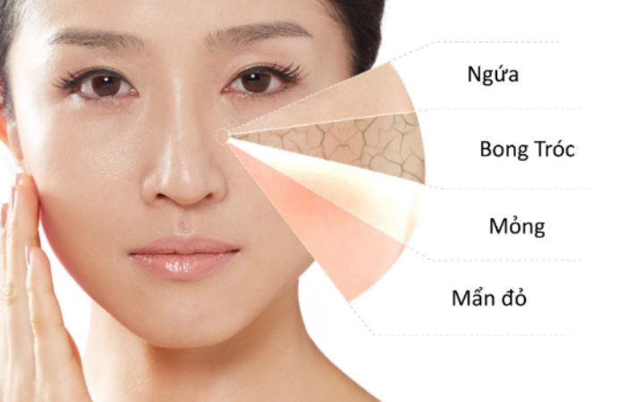 Dấu hiệu da bị kích ứng