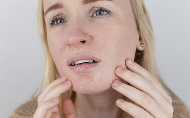 Những lưu ý cần biết tránh tình trạng da mặt sần sùi lỗ chân lông to