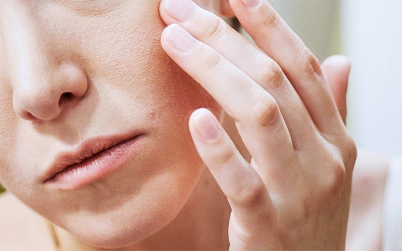 Tình trạng da mặt sần sùi lỗ chân lông to