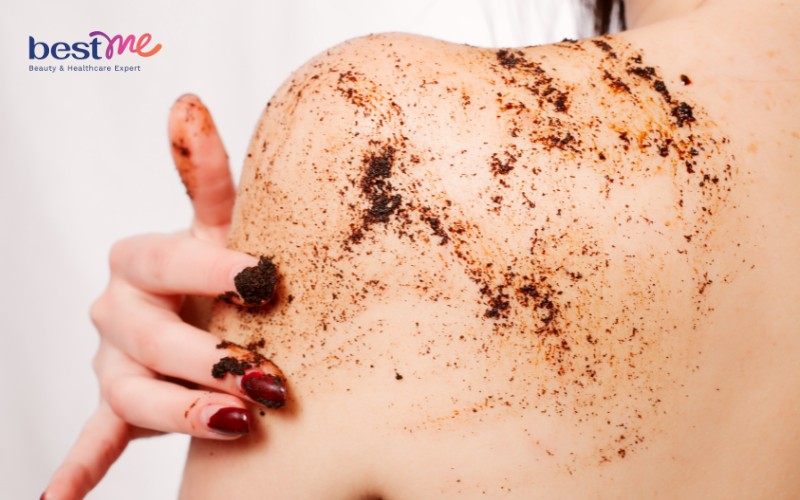 Da bị sạm do lâu ngày không tẩy tế bào chết