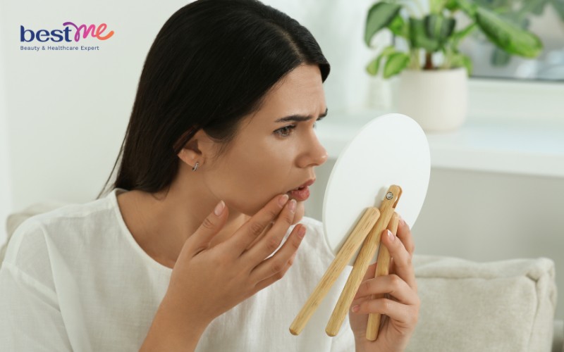 Thay đổi nội tiết tố cũng là một nguyên nhân dẫn đến sạm da