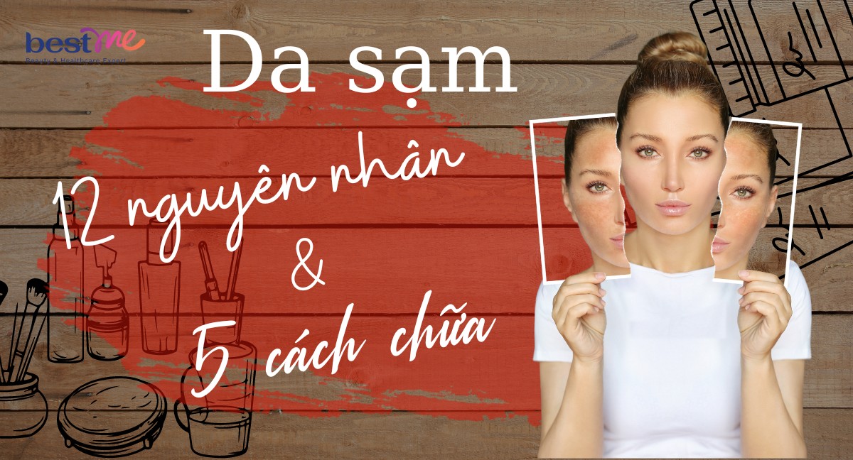 Da sạm: 12 nguyên nhân và 9 cách chữa sạm da hiệu quả