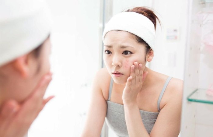 Da đang bị tình trạng mụn viêm nghiêm trọng thì không nên đắp mặt nạ
