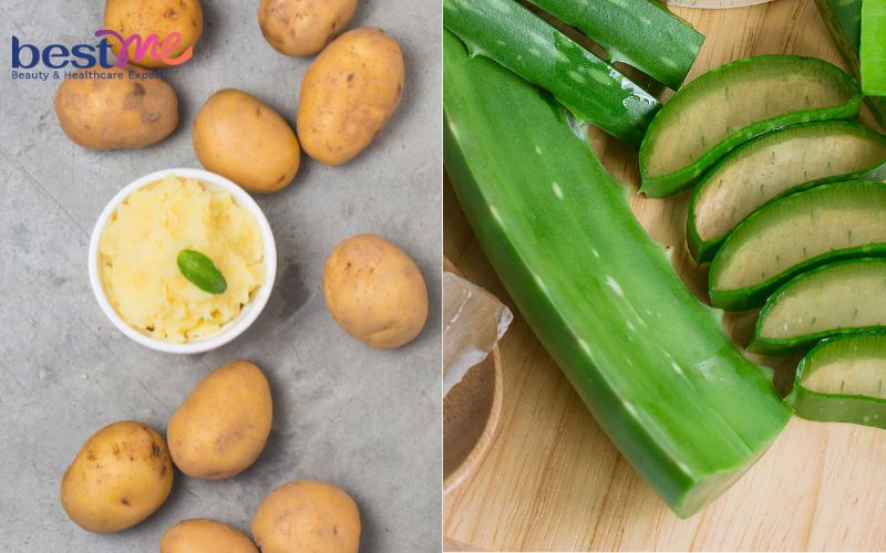 Mặt nạ nha đam và khoai tây 