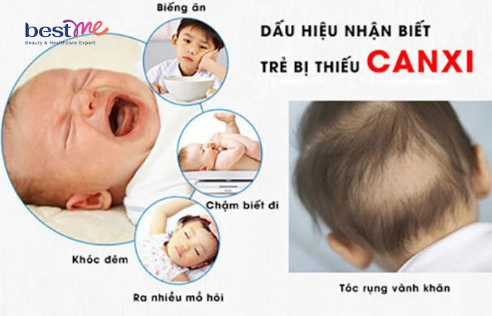 Dấu hiệu thiếu canxi ở trẻ sơ sinh 