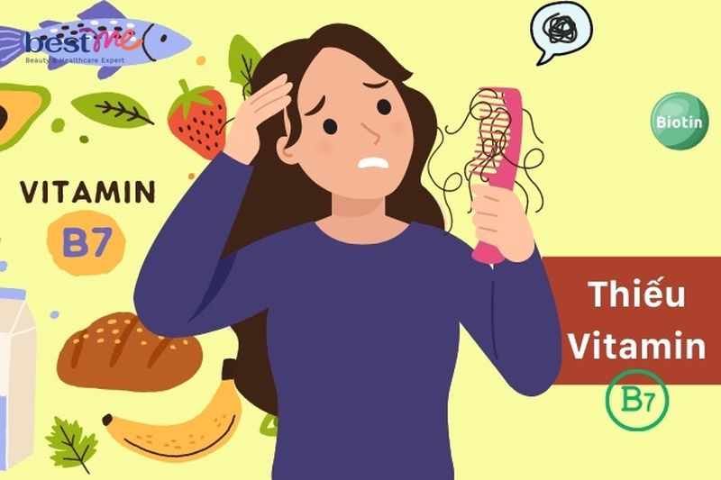 dau-hieu-thieu-vitamin-va-cach-bo-sung-day-du-1 Dấu hiệu thiếu vitamin và cách bổ sung đầy đủ - 1