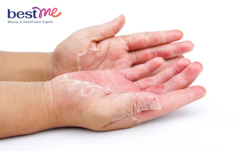 dau-hieu-thieu-vitamin-va-cach-bo-sung-day-du-12 Dấu hiệu thiếu vitamin và cách bổ sung đầy đủ - 12