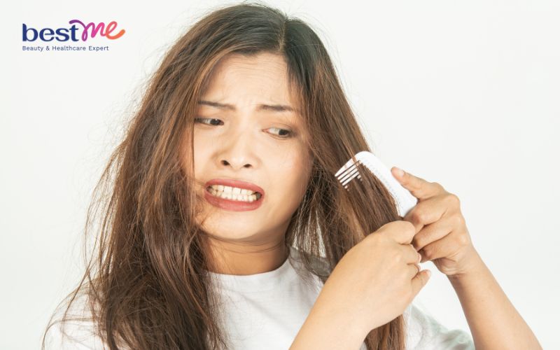 dau-hieu-thieu-vitamin-va-cach-bo-sung-day-du-3 Dấu hiệu thiếu vitamin và cách bổ sung đầy đủ - 3