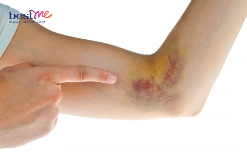 dau-hieu-thieu-vitamin-va-cach-bo-sung-day-du-4 Dấu hiệu thiếu vitamin và cách bổ sung đầy đủ - 4