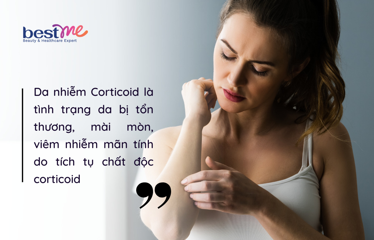 Tích tụ chất độc corticoid gây hại cho da