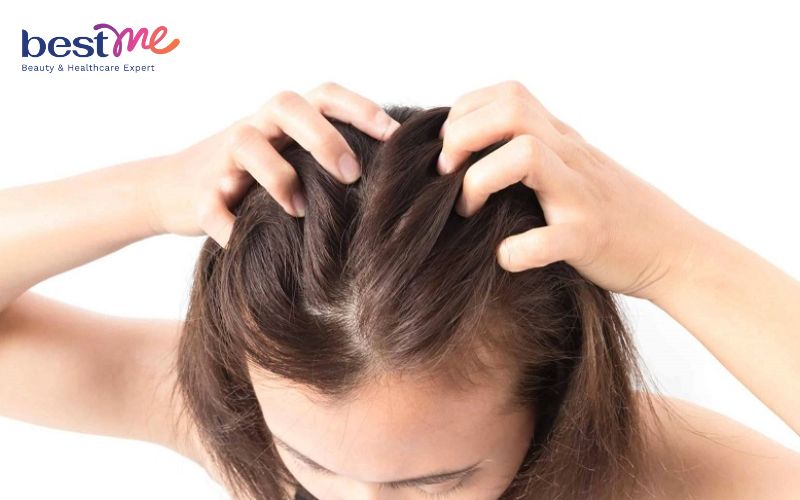 detox-da-dau-la-gi-cach-detox-da-dau-tai-nha-cho-sach-gau-het-ngua-12 Detox da đầu là gì? Cách detox da đầu tại nhà cho sạch gàu, hết ngứa - 12