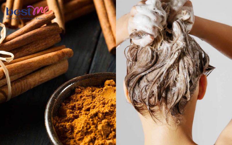 detox-da-dau-la-gi-cach-detox-da-dau-tai-nha-cho-sach-gau-het-ngua-5 Detox da đầu là gì? Cách detox da đầu tại nhà cho sạch gàu, hết ngứa - 5