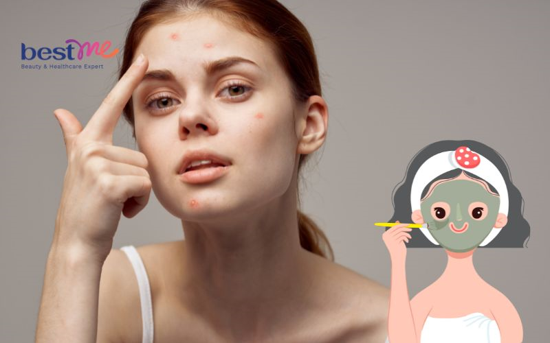 detox-da-mat-la-gi-co-nhung-loai-detox-thai-doc-da-mat-nao-2 Detox da mặt là gì? Có những loại detox thải độc da mặt nào? - 2