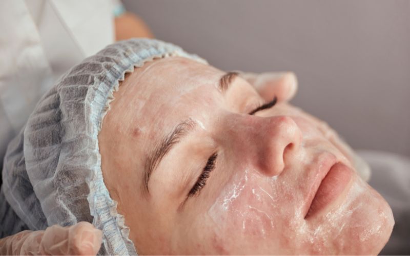 di-spa-nan-mun-tat-tan-tat-thong-tin-ban-can-phai-biet-10 Đi Spa nặn mụn: Tất tần tật thông tin bạn cần phải biết - 10