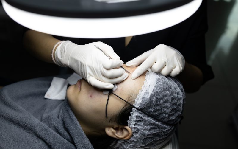 di-spa-nan-mun-tat-tan-tat-thong-tin-ban-can-phai-biet-2 Đi Spa nặn mụn: Tất tần tật thông tin bạn cần phải biết - 2