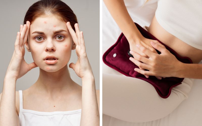 di-spa-nan-mun-tat-tan-tat-thong-tin-ban-can-phai-biet-9 Đi Spa nặn mụn: Tất tần tật thông tin bạn cần phải biết - 9