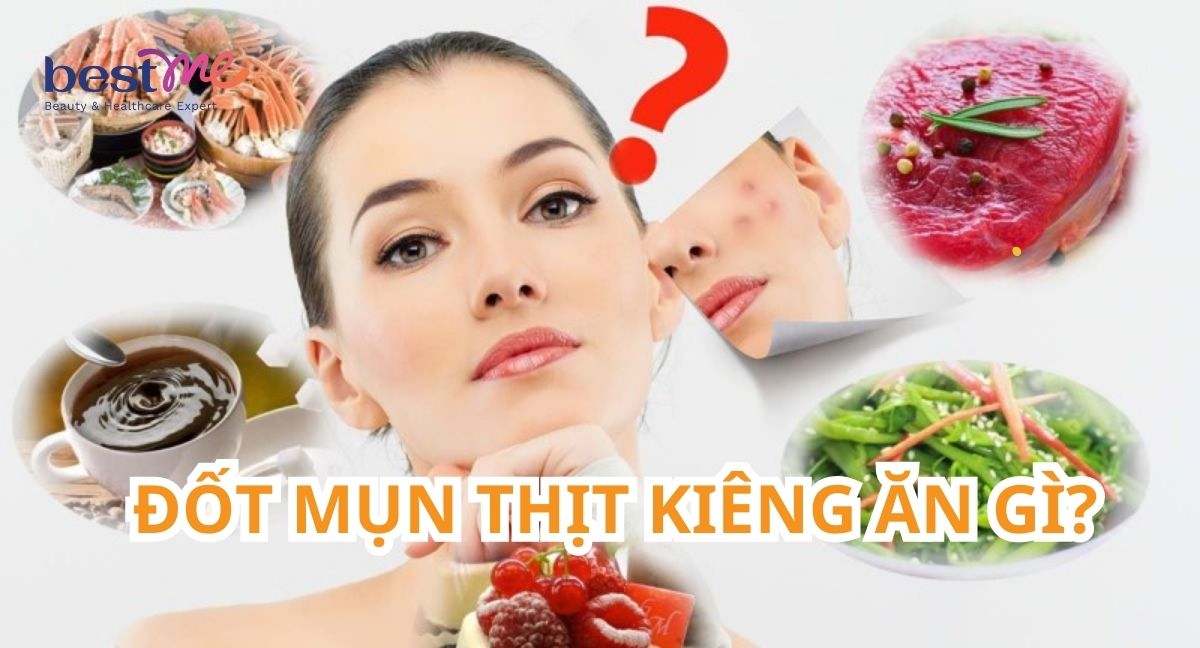 Sau khi đốt mụn thịt kiêng ăn gì? Kiêng bao lâu là tốt nhất?