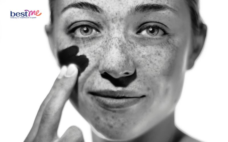 Dùng kem chống nắng bị mụn - 8 nguyên nhân và cách khắc phục - 2