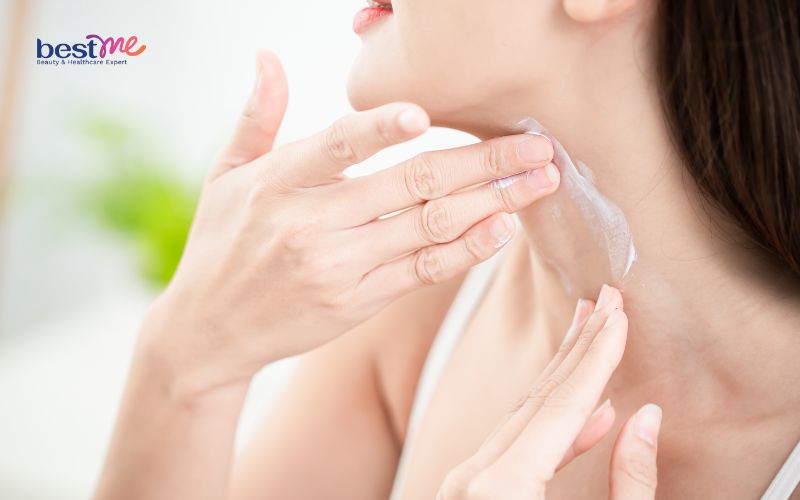 Dùng kem chống nắng bị mụn - 8 nguyên nhân và cách khắc phục - 5