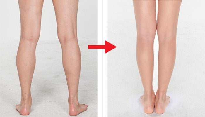 Đứng sai tư thế cũng là nguyên nhân khiến bắp chân to hơn