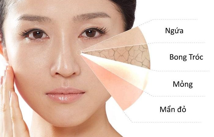 Một số tác dụng phụ khi sử dụng retinol không đúng cách