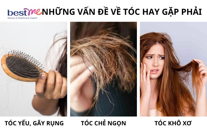 Giải pháp cho mọi vấn đề mà tóc thường gặp phải