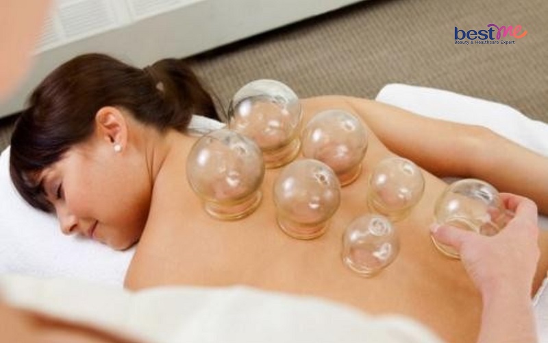 giac-hoi-bi-noi-mun-nuoc-phai-lam-sao-cach-xu-ly-an-toan-1 Giác hơi bị nổi mụn nước phải làm sao? Cách xử lý an toàn - 1