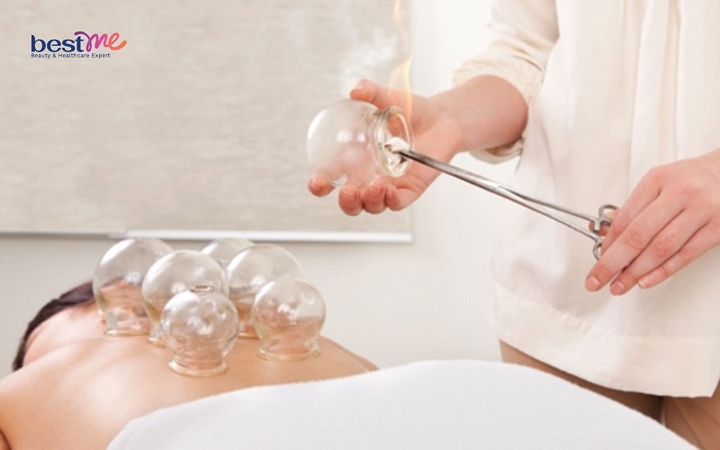 giac-hoi-bi-noi-mun-nuoc-phai-lam-sao-cach-xu-ly-an-toan-2 Giác hơi bị nổi mụn nước phải làm sao? Cách xử lý an toàn - 2