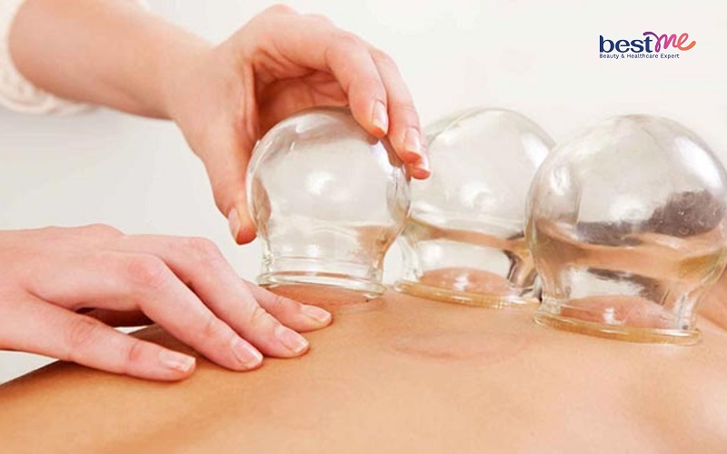 giac-hoi-bi-noi-mun-nuoc-phai-lam-sao-cach-xu-ly-an-toan-3 Giác hơi bị nổi mụn nước phải làm sao? Cách xử lý an toàn - 3