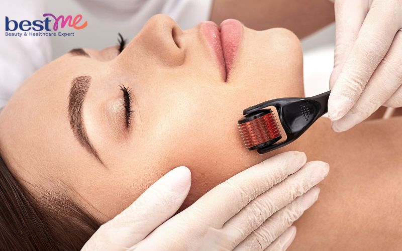 Giải mã Tranexamic Acid trị nám có hiệu quả và an toàn không? - 3