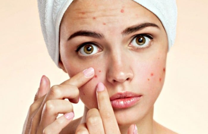 Sản phẩm giúp giảm mụn và thanh lọc cơ thể hiệu quả