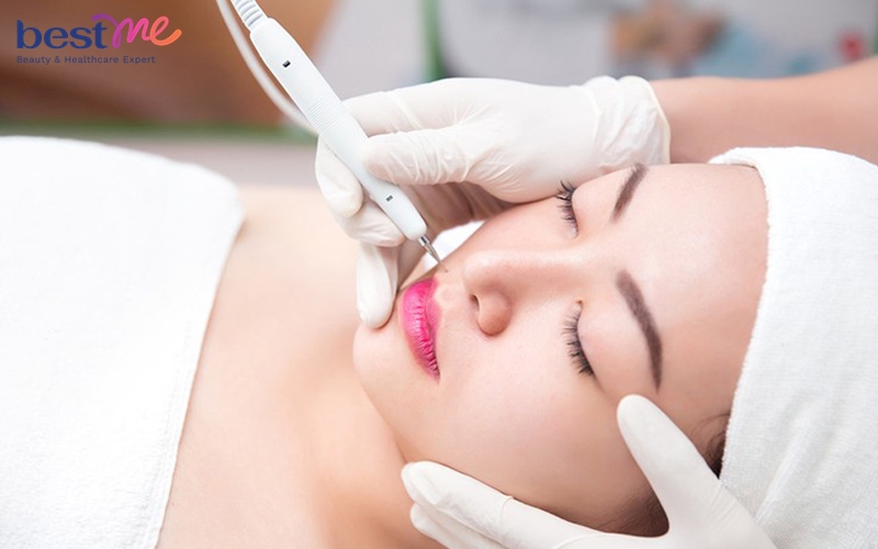 Giới thiệu máy chăm sóc da 5 in 1 M-1897 5 chức năng - 4