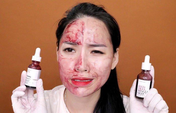 Video cảm nhận về peel da The Ordinary AHA 30% BHA 2%