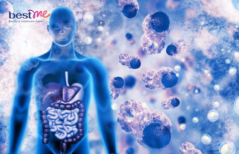 Hạt lanh giúp chống ung thư