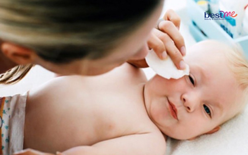 he-lo-cach-chua-mun-nhot-o-tre-em-hieu-qua-khong-the-bo-qua-5 Hé lộ cách chữa mụn nhọt ở trẻ em hiệu quả không thể bỏ qua - 5