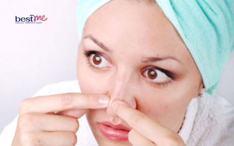 Hé lộ những cách trị mụn thịt ở mũi hiệu quả triệt để nhất - 3