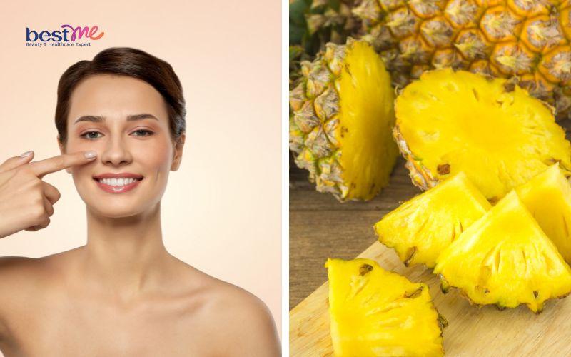 Hé lộ những cách trị mụn thịt ở mũi hiệu quả triệt để nhất - 4
