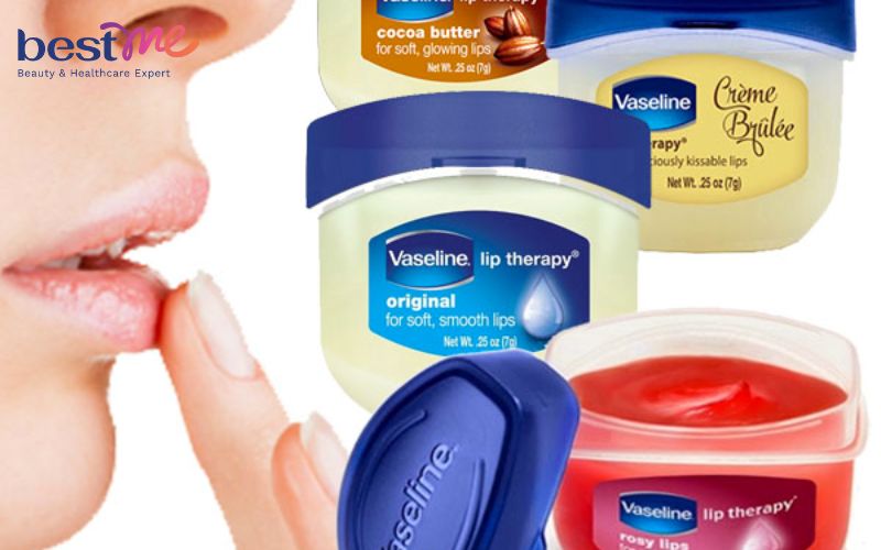 hoi-dap-vaseline-duong-moi-tri-tham-co-tot-khong-1 Hỏi đáp: Vaseline dưỡng môi trị thâm có tốt không? - 1