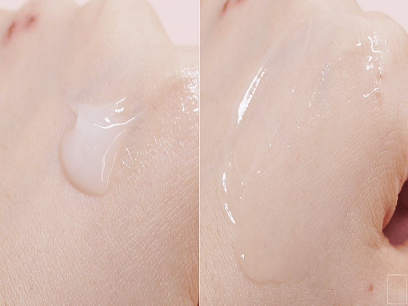 Dưỡng da cho da mun nên tối giản hay phức tạp hóa