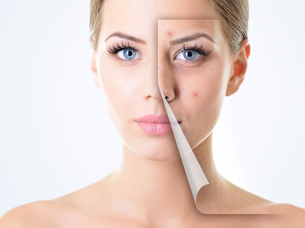 3 lời khuyên giúp bạn chọn sản phẩm chăm sóc da nhạy cảm phù hợp