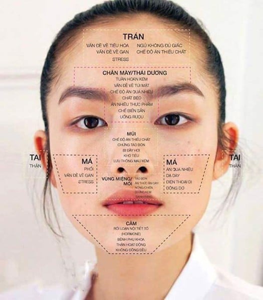 Nguyên nhân gây mụn