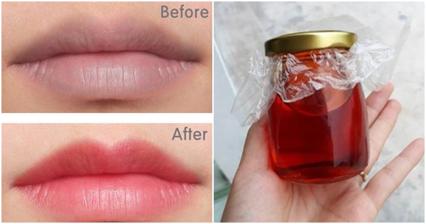 Dưỡng Môi Hồng Căng Mọng - Cần Lựa Chọn Những Thành Phần Nào? - 5